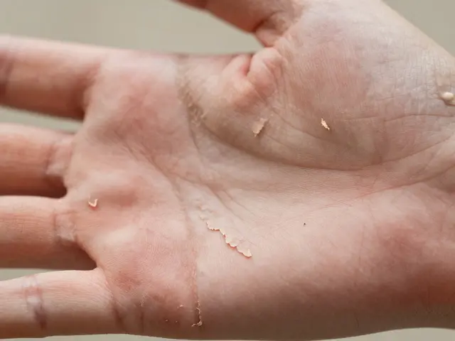 Proč se mi loupou dlaně? Příčiny, řešení a tipy na péči